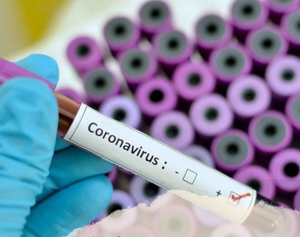 ШЫМКЕНТТЕ ІНДЕТТЕН ҚАЗЫҒҰРТ АУДАНЫНЫҢ ТҰРҒЫНЫ КӨЗ ЖҰМДЫ