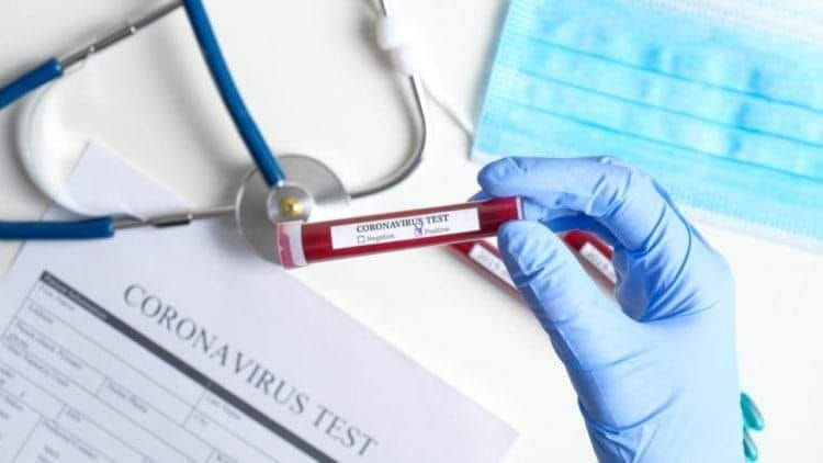 ШЫМКЕНТТЕ «COVID-19» ИНФЕКЦИЯСЫН ЖҰҚТЫРҒАН ТАҒЫ 3 ЖАҒДАЙ АНЫҚТАЛДЫ