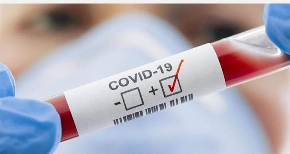 ШЫМКЕНТ: ДӘРІГЕРЛЕР САҚТЫҚ ШАРАЛАРЫН КҮШЕЙТУДІ ЕСКЕРТЕДІ