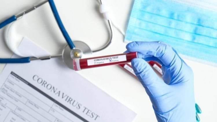 ШЫМКЕНТТЕ КОРОНАВИРУС ЖҰҚТЫРҒАН 6 ЖАҒДАЙ ТІРКЕЛДІ